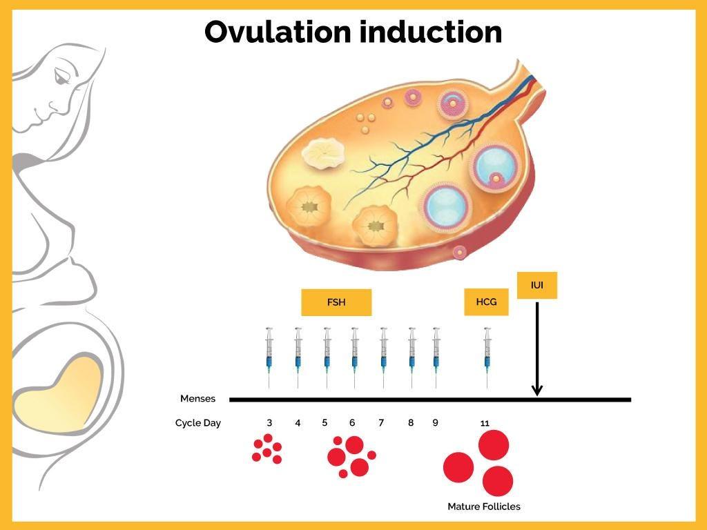 Ovulation Induction